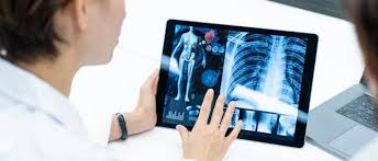 Teleradiología